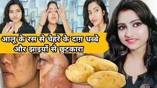 चेहरे पर pimples के दाग धब्बे और जिद्दी झाइयो को जड़ से खत्म करे | how to remove pigmentation at home