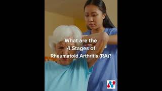 What Are the 4 Stages of Rheumatoid Arthritis?