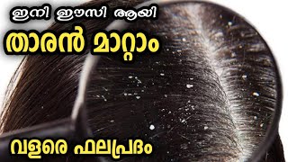 താരൻ മാറ്റാൻ ഇത് മതി വളരെ ഫലപ്രദം | dandruff | thran | The Malayalam Vlogs