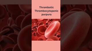 Thrombotic Thrombocytopenic Purpura #medicine #ttp