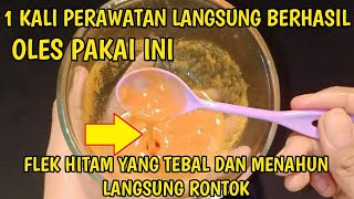 CARA MENCERAHKAN WAJAH, MENGHILANGKAN FLEK HITAM YANG TEBAL DAN MENAHUN DAN MENGHILANGKAN KERUTAN