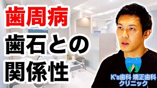 歯周病と歯石の関係とは？【流山市おおたかの森の歯医者 K's歯科 矯正歯科クリニック】