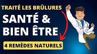 Traité les brûlures | tutoriel remède naturel [ Naturopathie ]