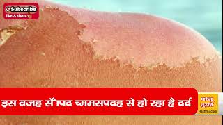 इस वजह से Skin Peeling से हो रहा है दर्द - Natural Home Remedy Gharelu Nuskhe