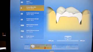 cerec 101