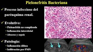 Infecciones Renales   FAARDIT