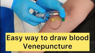 How to draw blood. Venepuncture. Blood sample for PRP Platelet rich plasma. #venepuncture #blooddraw