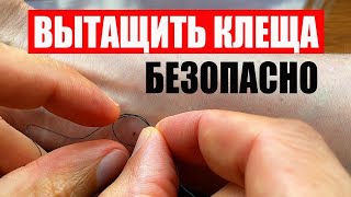 Как Вытащить Клеща Ниткой БЕЗОПАСНО