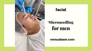 Microneedling for men