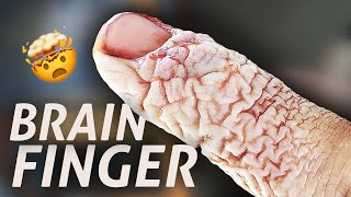 Brain Finger | FPV Drone Accident