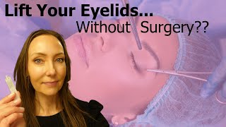 LIFT YOUR EYELIDS: Without Surgery? 👀