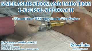 KNEE ASPIRATION / INJECTION LATERAL APPROACH - In-Vivo Series