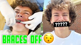 A NEW SMILE | GETTING BRACES OFF AFTER 2 YEARS | TURIN BINGHAM WITH NO BRACES | MILLION DOLLAR SMILE