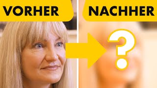 Facelift VORHER / NACHHER Ergebnis bei 49-jähriger Patientin | Dr. Jungwirth - Plastische Chirurgie