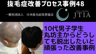 【抜毛症】改善事例48:10代男⼦学⽣丸坊主からどうしても脱出したいと頑張った