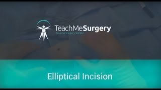 Surgical Skills - Elliptical Incision of a Skin Lesion