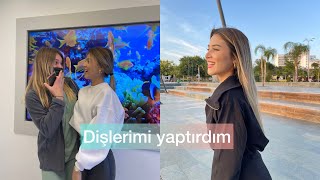 Sonundaa dişlerimi yaptırdım🦷Köprü tedavisi süreci 🥳 Acıdı mı ?