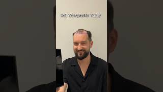 Hair Transplant in Turkey | Hair Transplant Process #hairtransplant