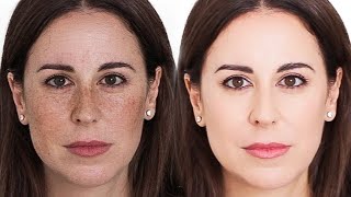 MANCHAS: ¿Cómo eliminar las manchas faciales? | Miriam Llantada