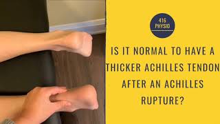 Achilles tendon thickening after a rupture