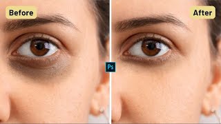 How to Remove Dark Circles in Photoshop