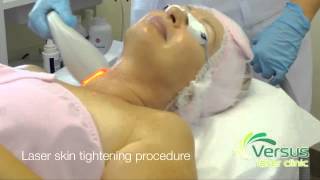 Laser Skin Tightening step by step demonstration