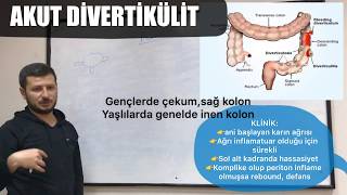 DİVERTİKÜLİTİ OLAN HASTANIN ACİL SERVİS YÖNETİMİ