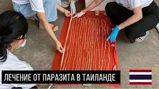 Лечение от 10 метрового паразита в Таиланде