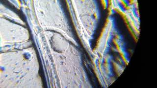 ONION CELL WALL, CYTOPLASM AND NUCLEUS -SURFACE VIEW