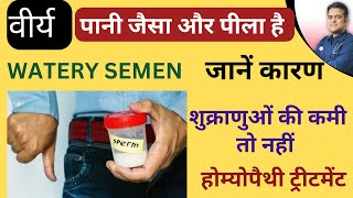 वीर्य पानी जैसा और पीला होने का कारण । Cause of watery semen । Best treatment ।