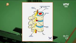 Hernia de disco - Dr. Isaac Jakter