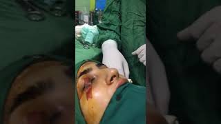 الدكتور علي اكبر صادقي جراحة تجميل الانف 00989398297154 WhatsApp #تجميل الانف في ايران