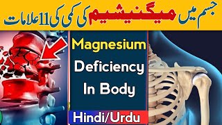 11 Symptoms Of Magnesium Deficiency In Body