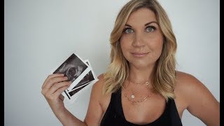 17/18 Weeks Pregnant | Baby Number 3