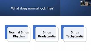 Adult Med/Surg: Dysrhythmia NEW Lecture Normal Sinus Rhythm