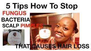 5 Tips How To Stop Fugus,Bacteria and Scalp Pimples, That causes hair LOSS!