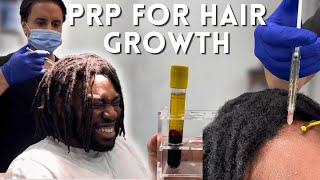 Hair PRP Treatment On Dreadlocks For The First Time! | Best Treatment For Hair Thinning & Alopecia