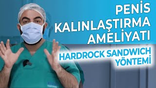 Kalıcı Penis Kalınlaştırma Ameliyatı | Hardrock Sandviç Yöntemi