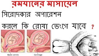 সিৱোদকাৱ অপরেশন করলে কি ৱোযা ভেংগে যাবে ?