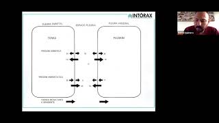 CLASE: “TORACOSTOMIA Y SISTEMA DE DRENAJE PLEURAL(SDP)Estudiantes VIII Semestre UPA .1/02/2021