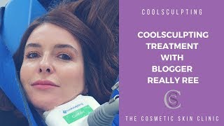 CoolSculpting Treatments With Blogger Really Ree  | The Cosmetic Skin Clinic