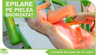 Epilarea Definitiva pe Pielea Bronzata: DA sau BA?