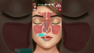 nose operation#girl nose operation 👉g_k##gaming. #trending #short #videos #3d game